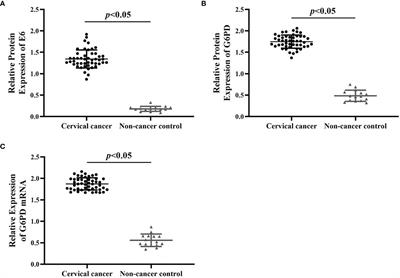 HPV16 E6 Promotes the Progression of HPV Infection-Associated Cervical Cancer by Upregulating Glucose-6-Phosphate Dehydrogenase Expression